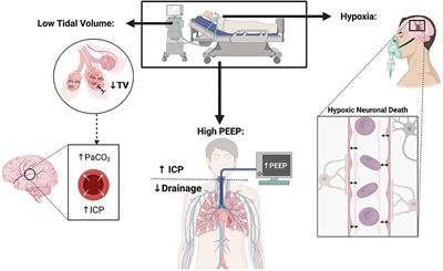 Mechanical ventilation in acute brain injury patients with acute respiratory distress syndrome